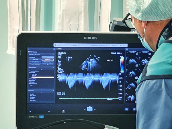 Premieră pentru chirurgia cardiovasculară din Transilvania: o echipă medicală din Sibiu a realizat o intervenție transcateter complexă de implantare a unei valve Sapien3 într-o proteză biologică mitrală degenerată