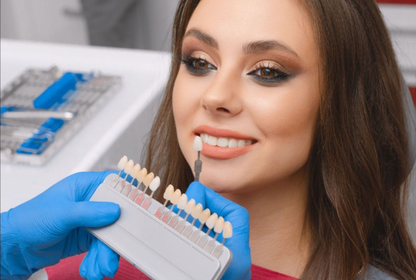 Sunt fațetele dentare foarte albe recomandate de dentiști?