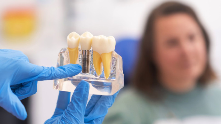 Etapele implantului dentar