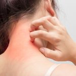 Îngrijirea pielii după un tratament cu laser: 3 sfaturi dermatologice esențiale Sursa foto: Shutterstock via Uriage